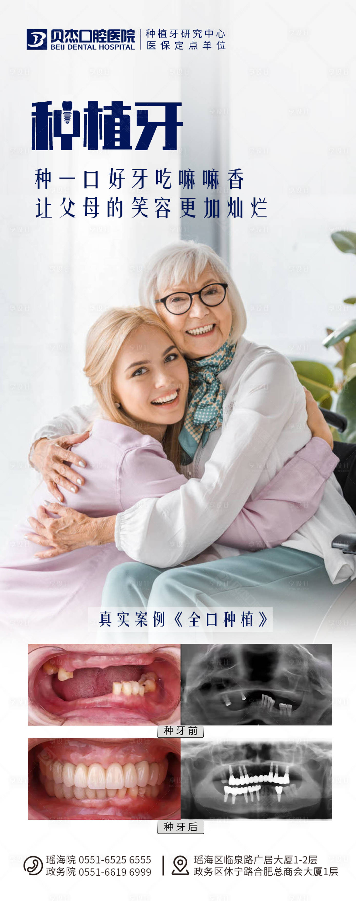 源文件下載【享設計】搜索編號：34560010250706867【輪椅上的老奶奶種植牙案例圖】
