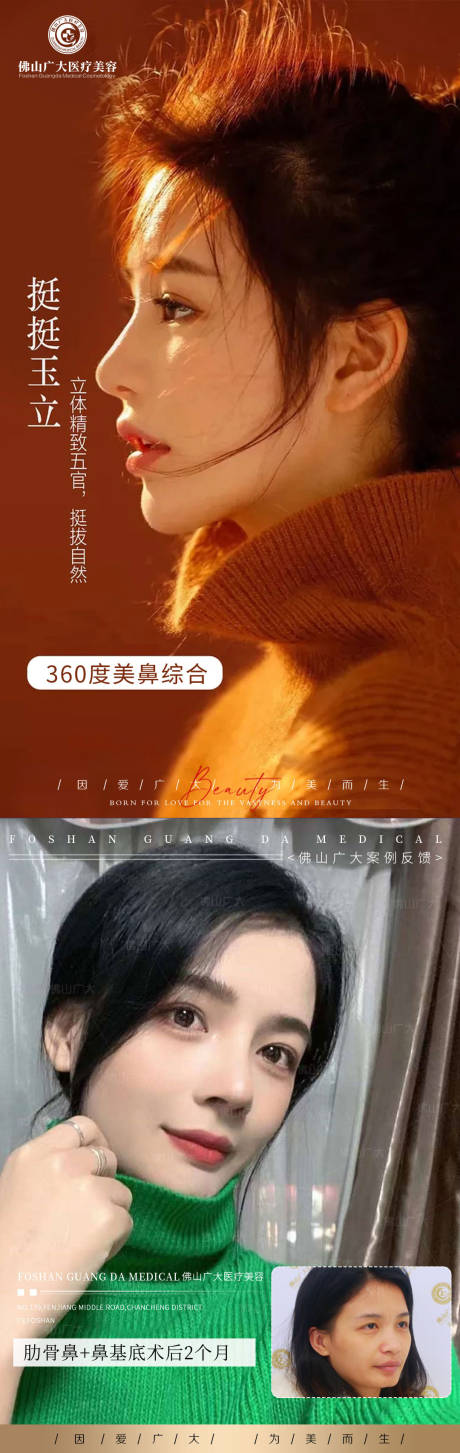 源文件下载【享设计】搜索编号：31540009785028876【鼻部整形案例】