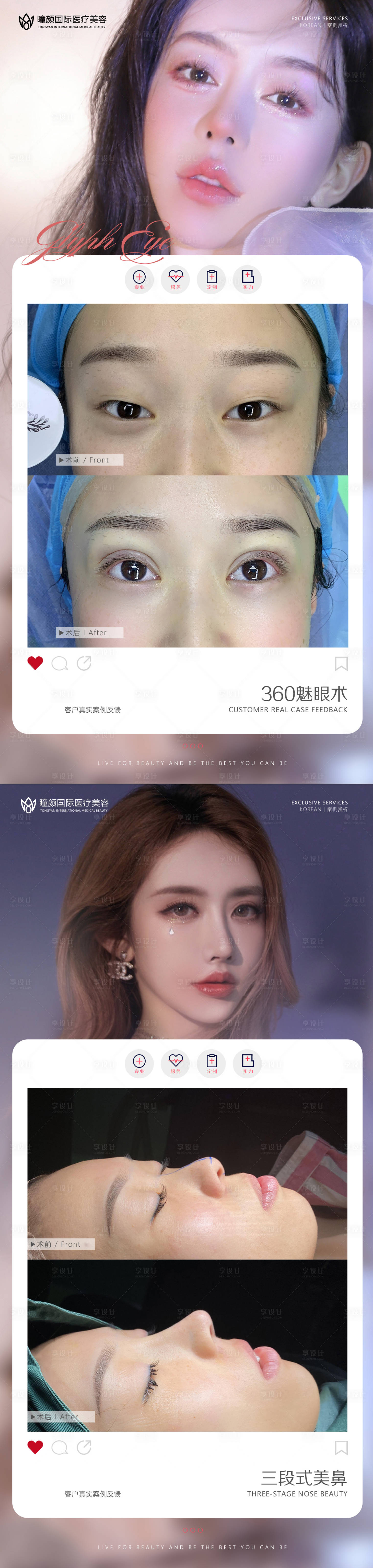 源文件下载【享设计】搜索编号：26930009823882739【医美案例对比系列海报】