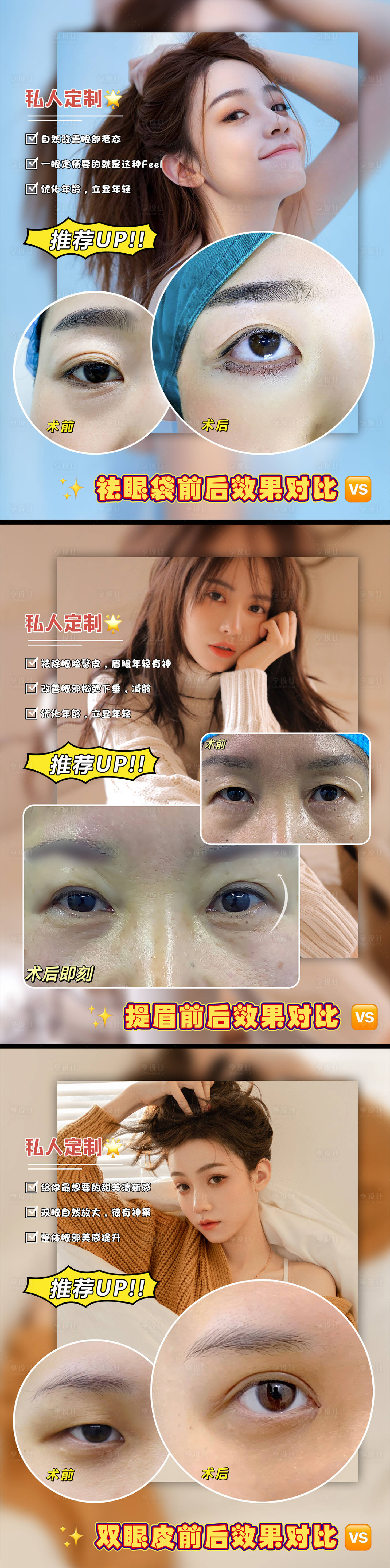 源文件下載【醫美案例對比】編號：20610009879086179