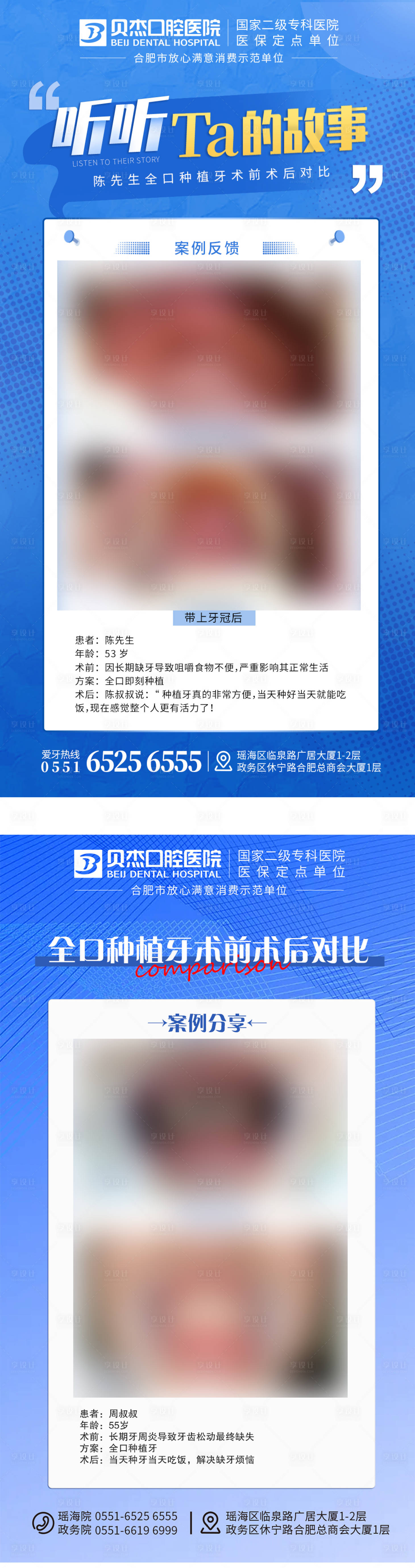 源文件下載【享設計】搜索編號：10580010250684506【多顆種植牙案例圖】