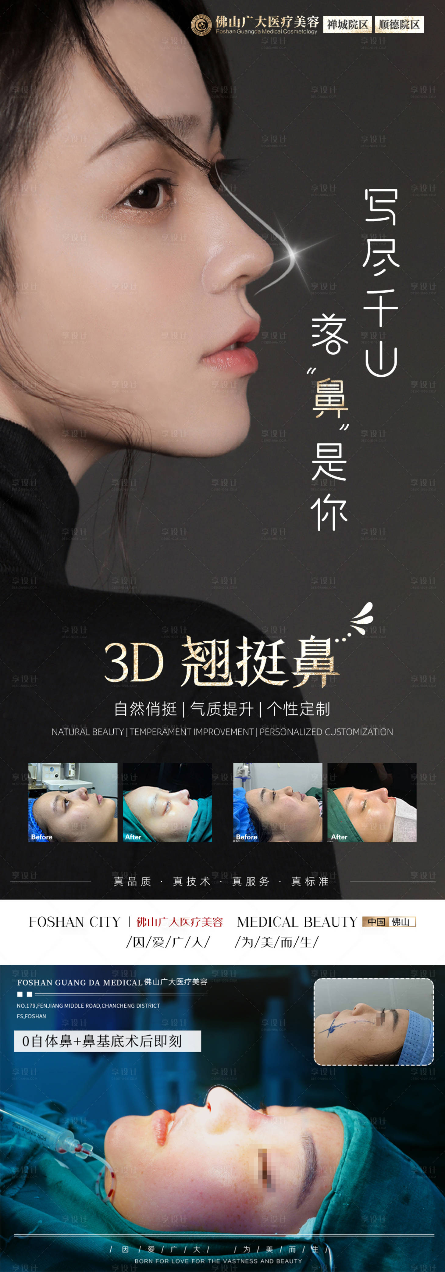源文件下載【醫美鼻子活動案例科普】編號：61750009782851224