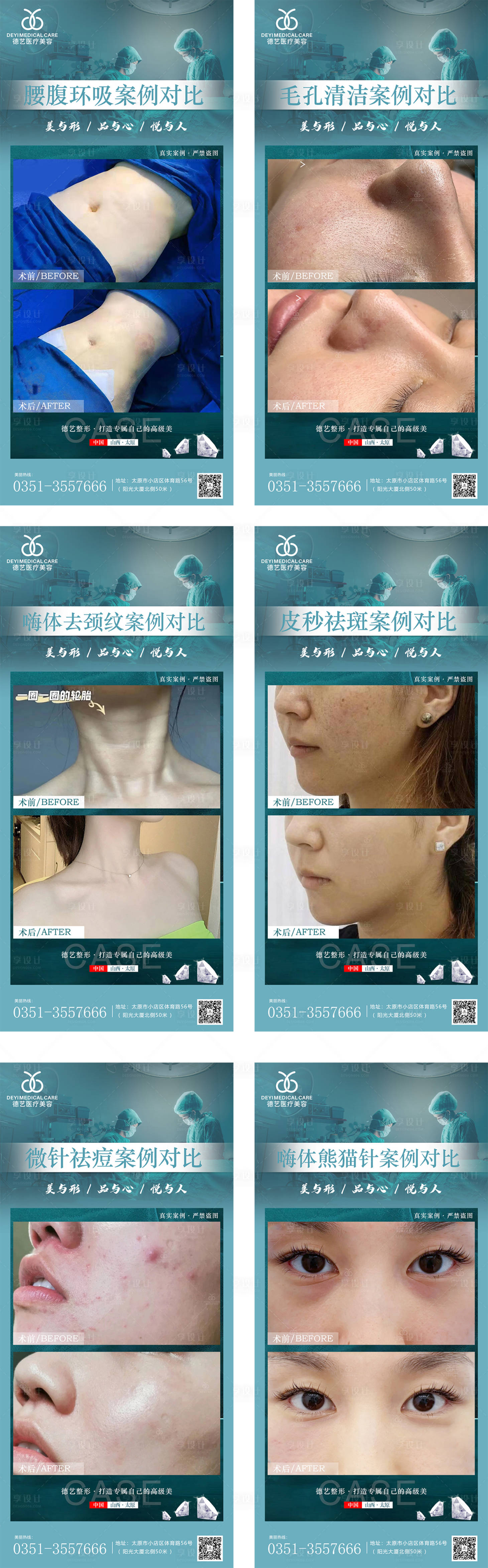 源文件下载【医美案例对比图】编号：78740009958167529
