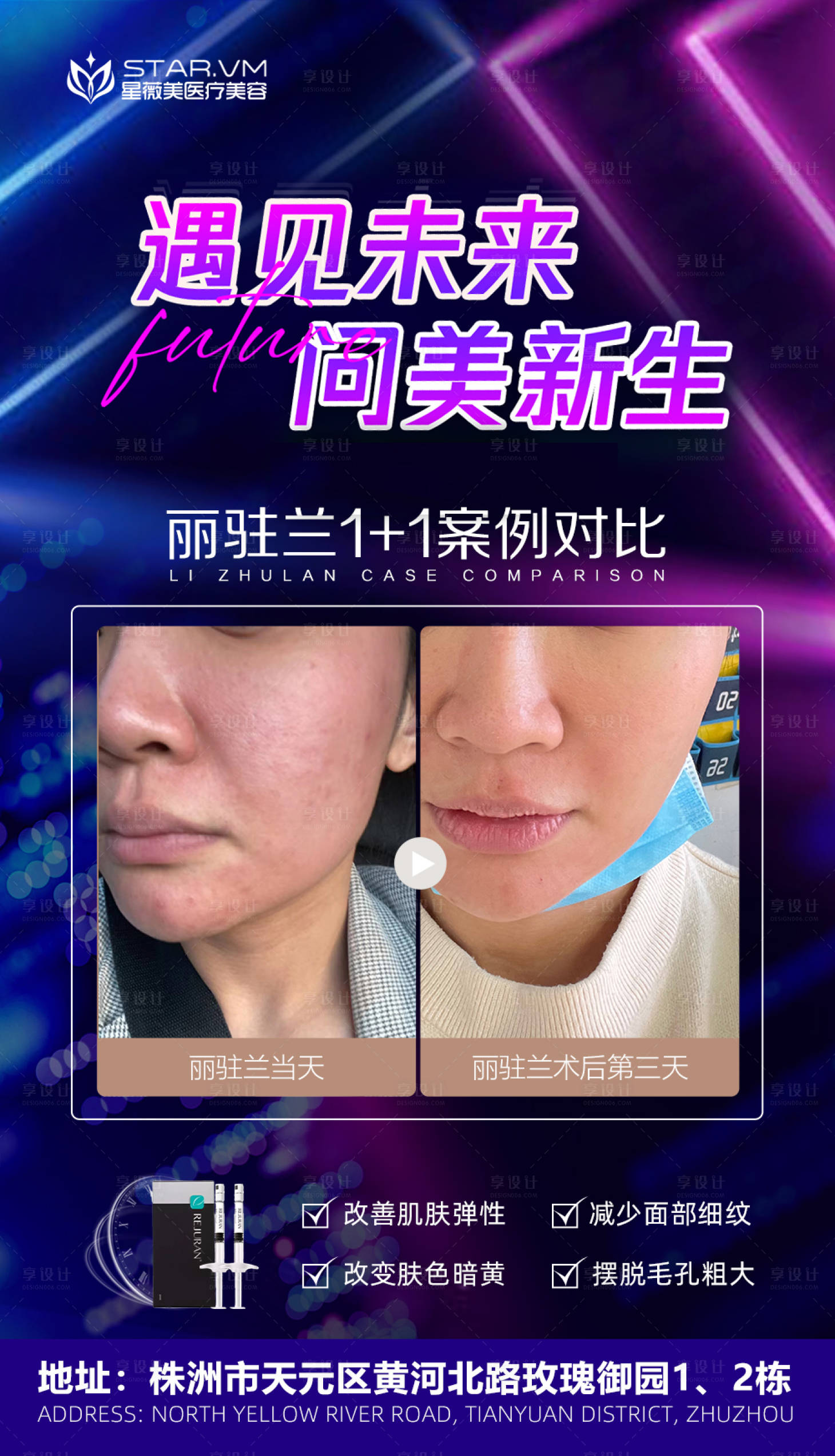源文件下载【医美整形案例对比海报】编号：65180009811503050
