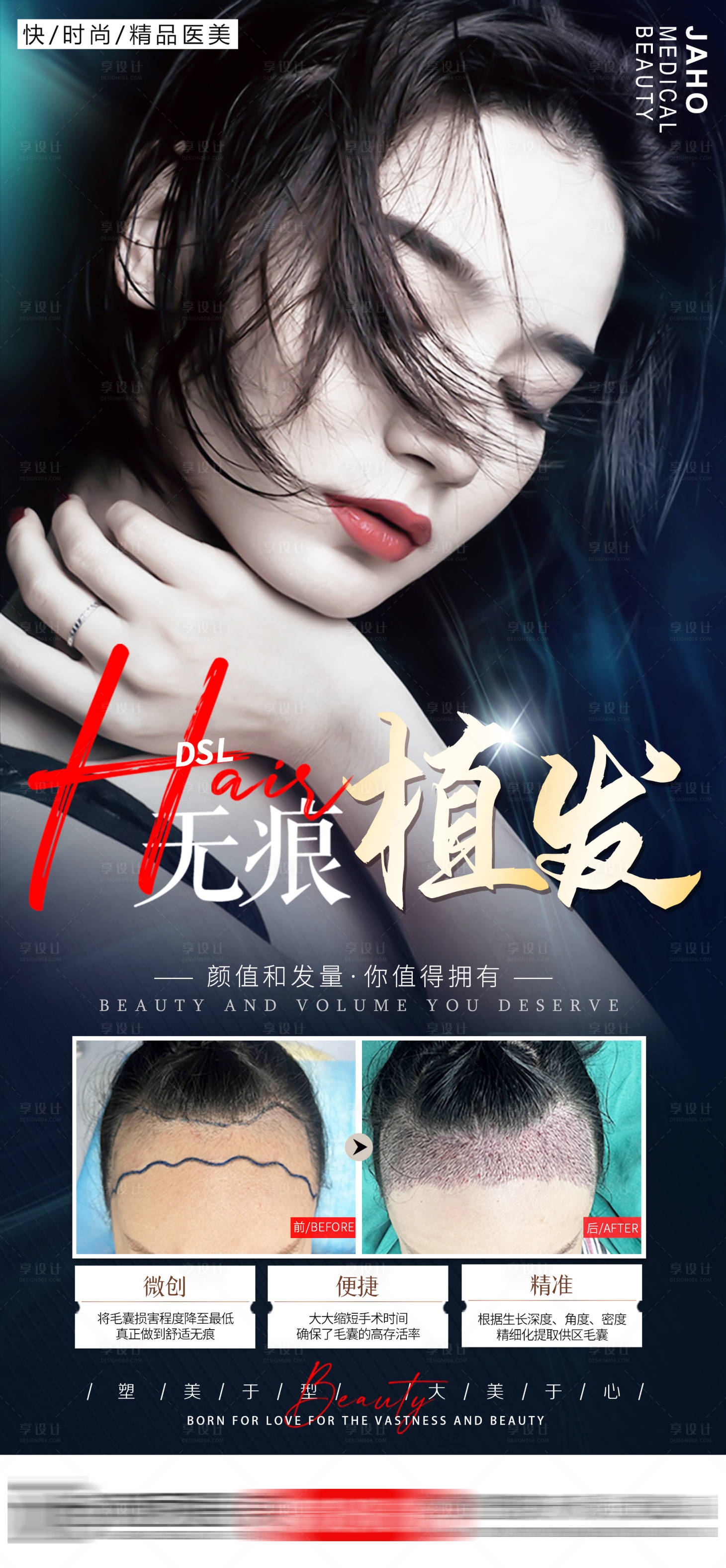 源文件下載【享設計】搜索編號：26710010174476575【植發海報】