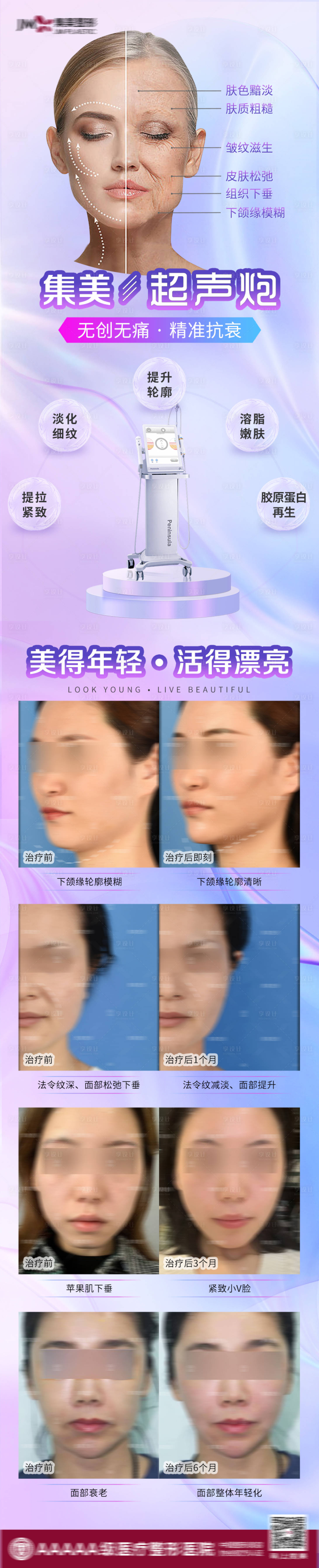 源文件下載【享設(shè)計(jì)】搜索編號(hào)：73600010193069033【醫(yī)美超聲炮案例長圖海報(bào)】
