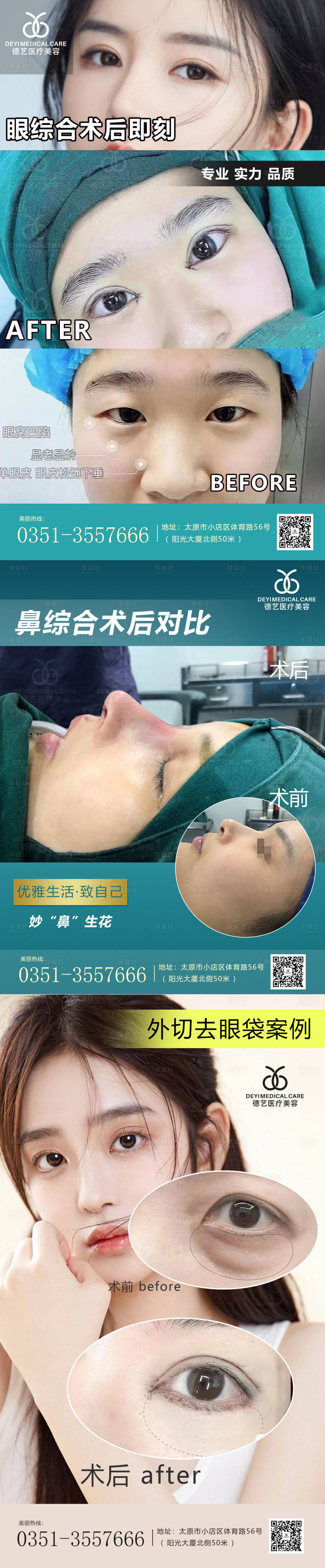 源文件下载【享设计】搜索编号：83300010133809479【医美案例对比图】