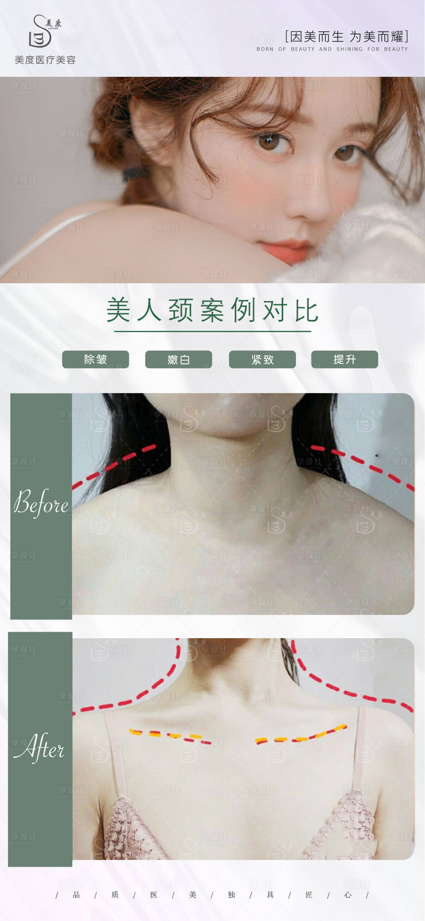 源文件下載【享設計】搜索編號：38260009785686091【醫美案例對比圖】