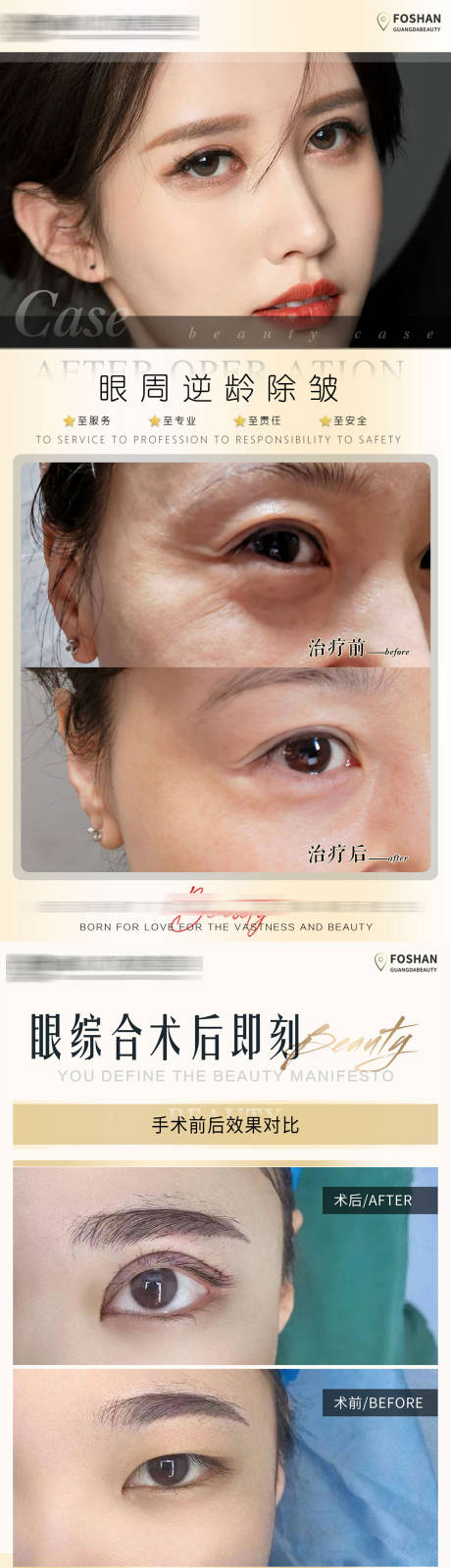 医美案例对比图