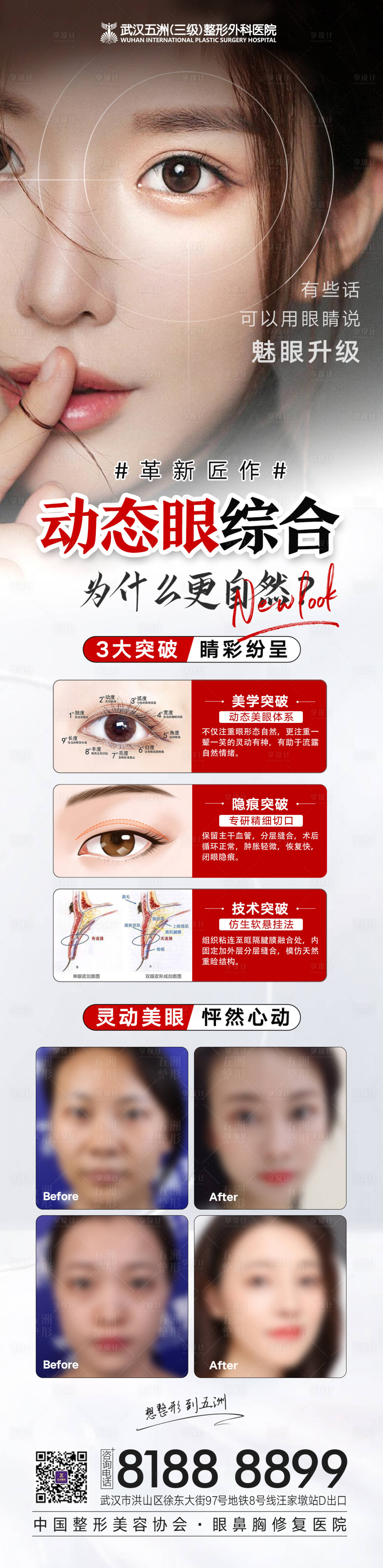 源文件下載【享設計】搜索編號：85220010130105507【醫美雙眼皮整形長圖海報】