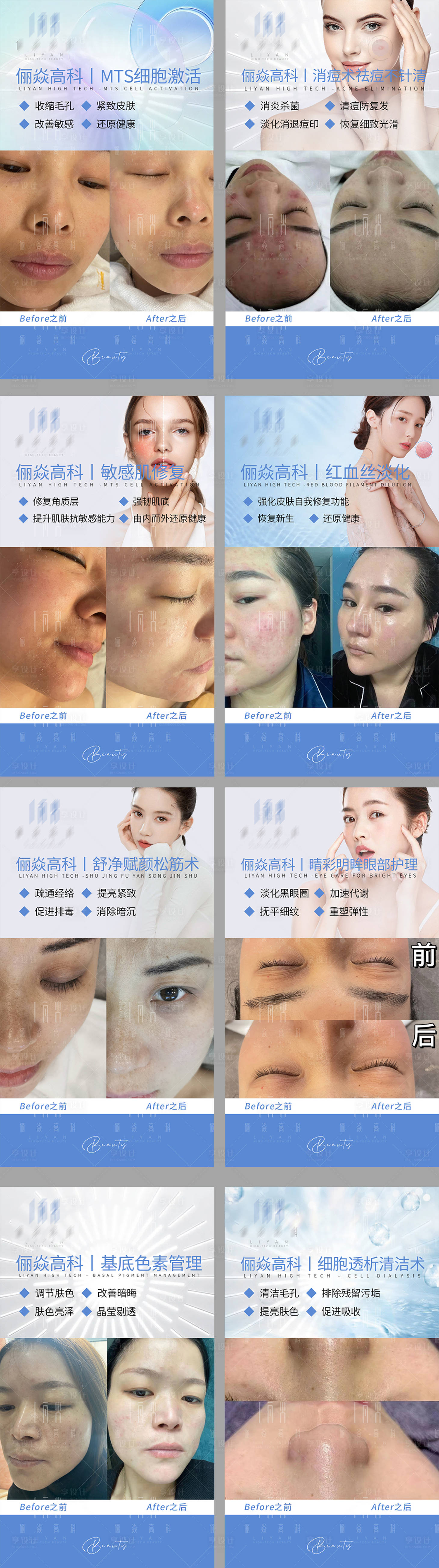 源文件下载【享设计】搜索编号：21760009836601404【医美案例对比海报】