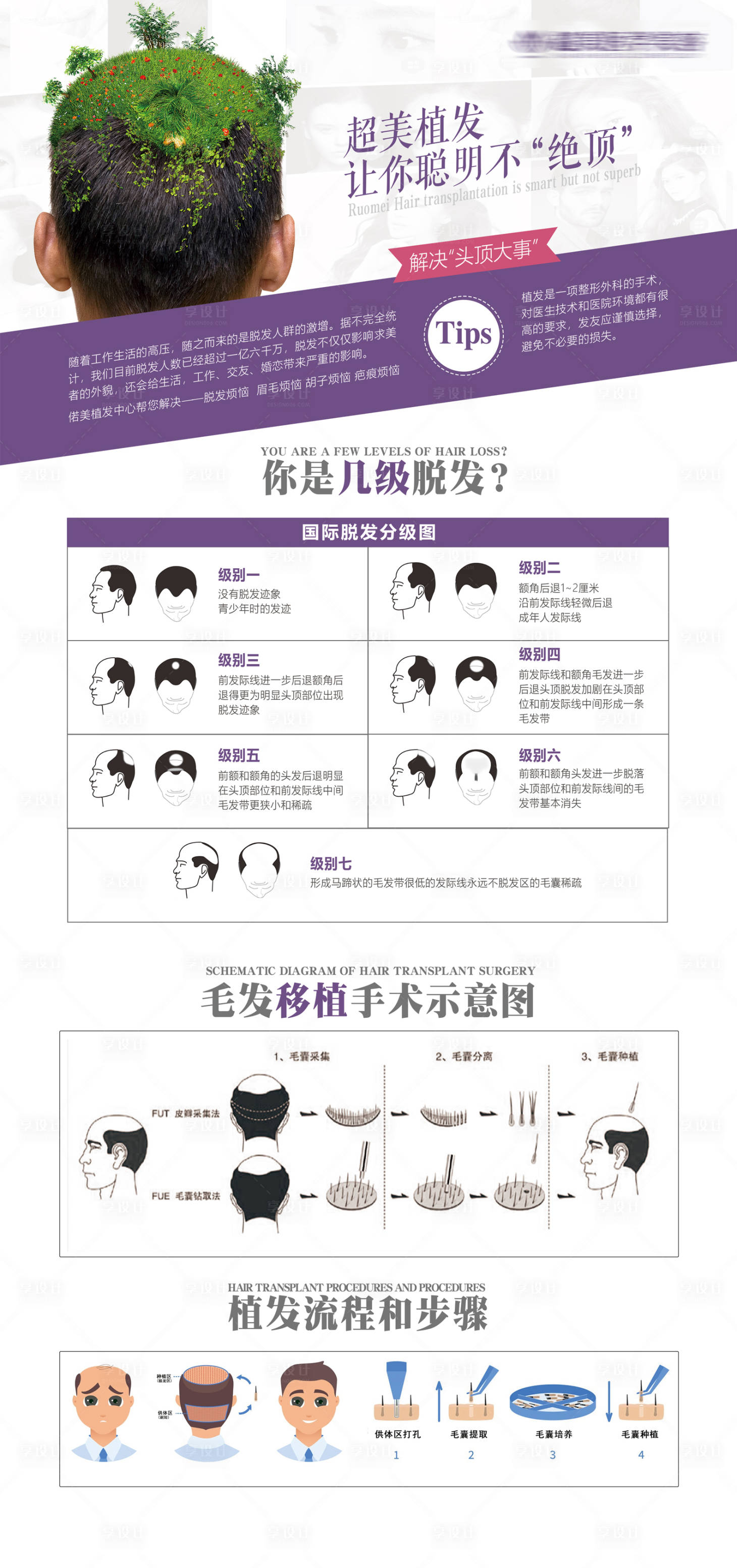 源文件下載【享設計】搜索編號：90230009875557771【植發科普】