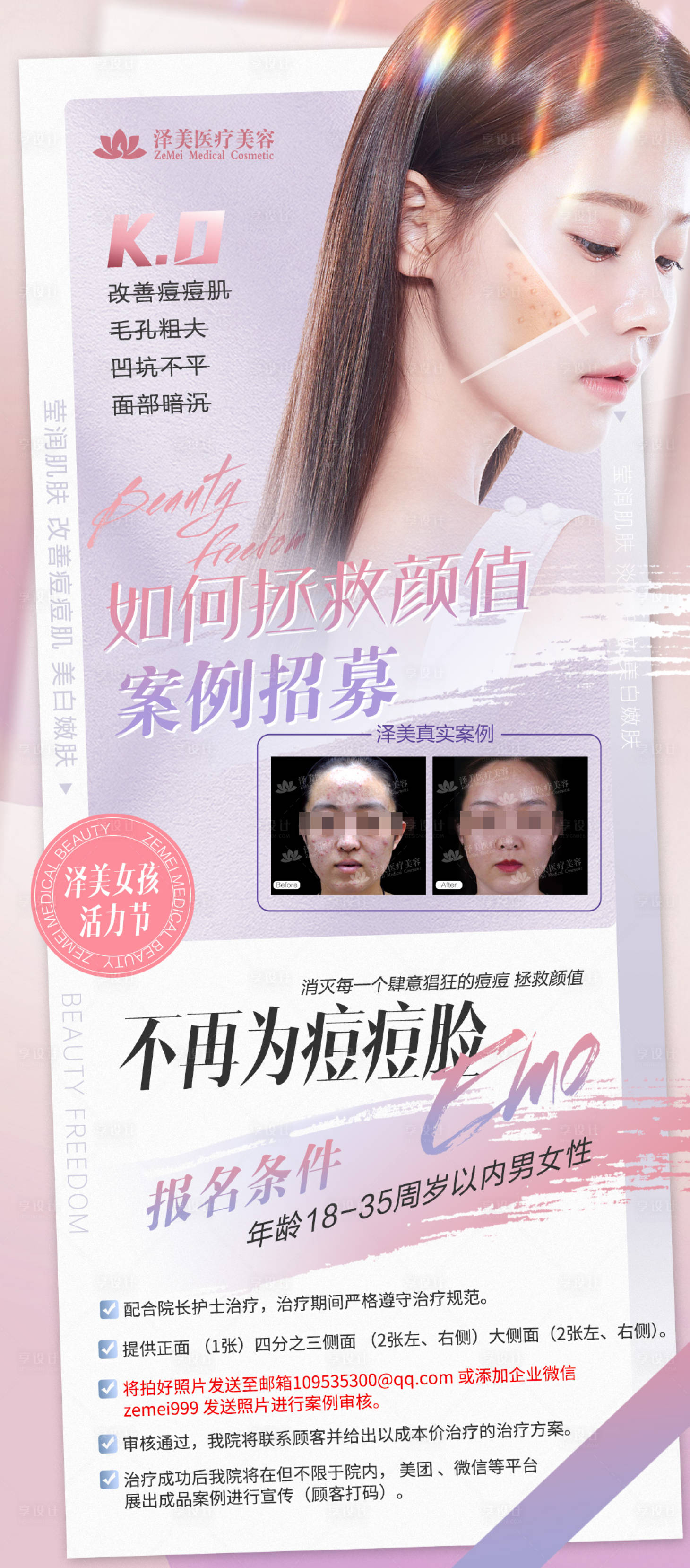 源文件下载【享设计】搜索编号：86040010644901470【医美痘肌案例招募案例对比系列海报】