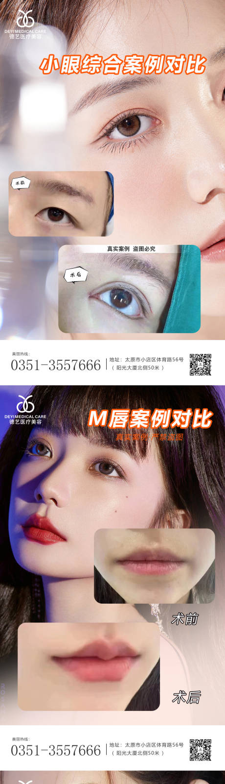 源文件下载【医美案例对比图】编号：89860010480646413