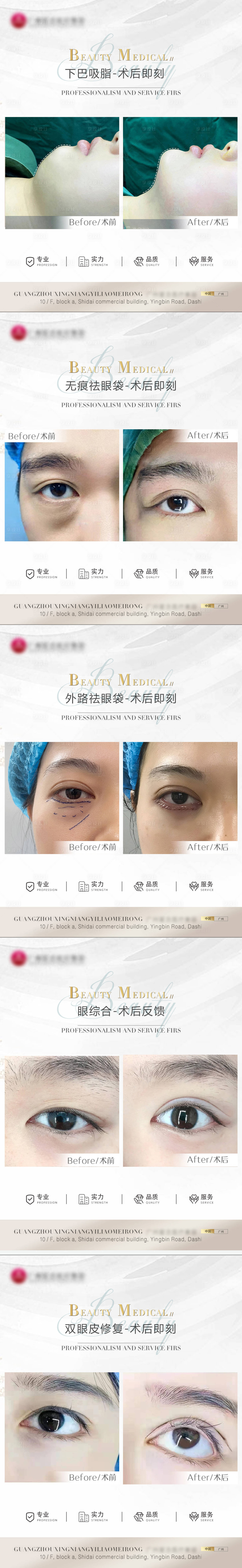 源文件下载【医美案例模板系列海报】编号：68680010653486315