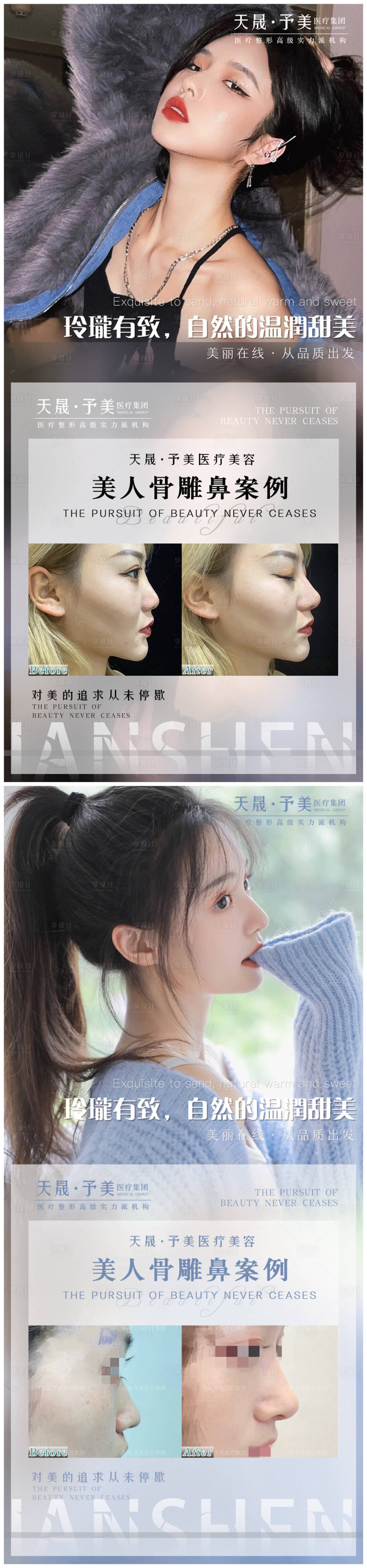 源文件下載【享設計】搜索編號：59180010488768187【醫美隆鼻案例】