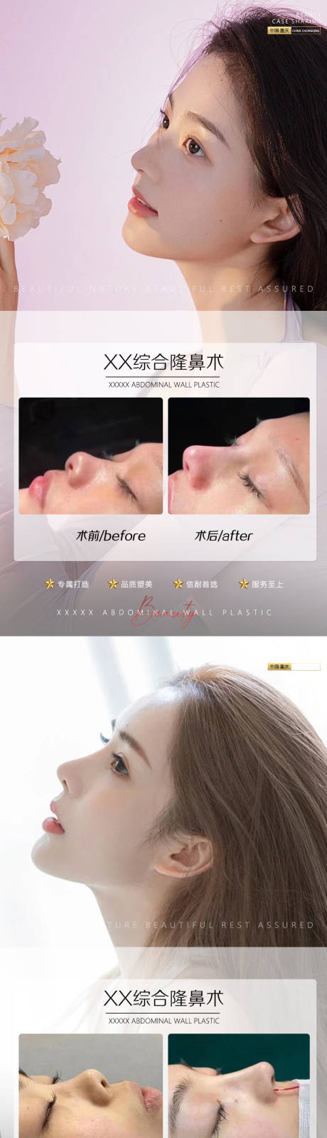 源文件下载【医美案例鼻子】编号：30270010500921082