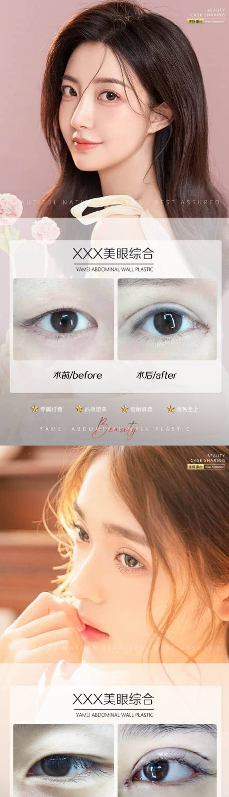 源文件下載【享設計】搜索編號：33190010473142413【醫美案例對比系列海報】