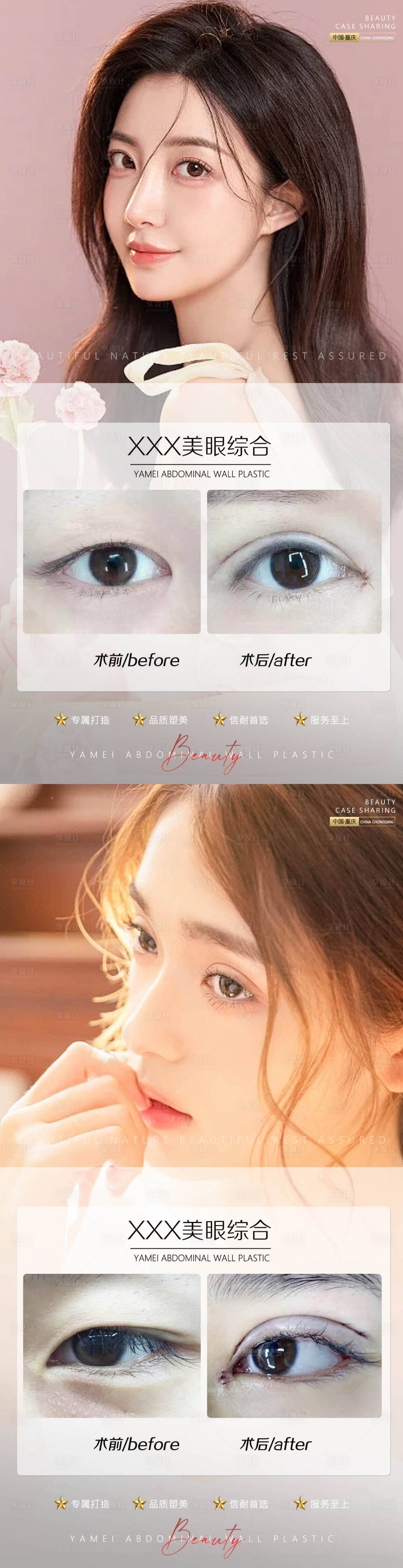 源文件下載【享設計】搜索編號：33190010473142413【醫美案例對比系列海報】