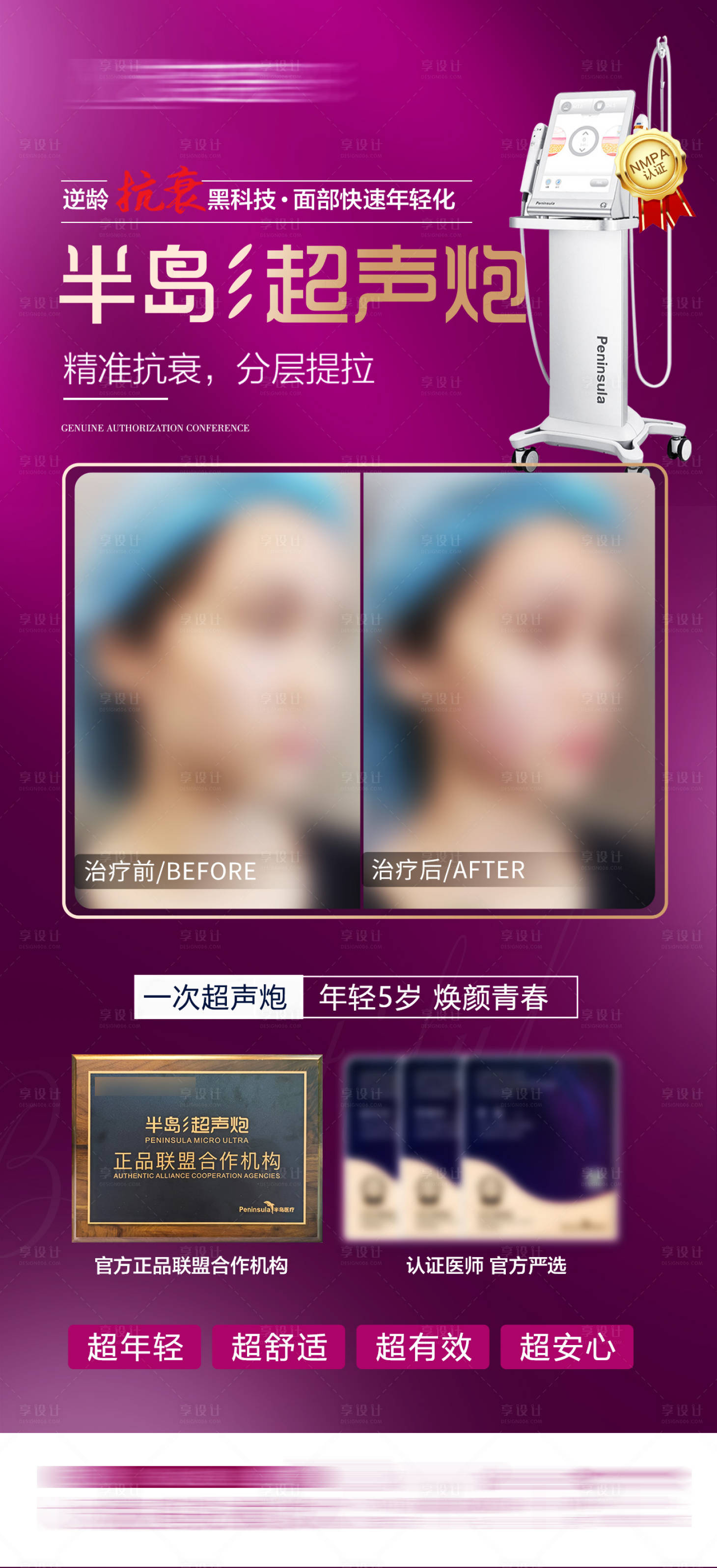 源文件下载【享设计】搜索编号：23510010734219097【整形医美超声炮】