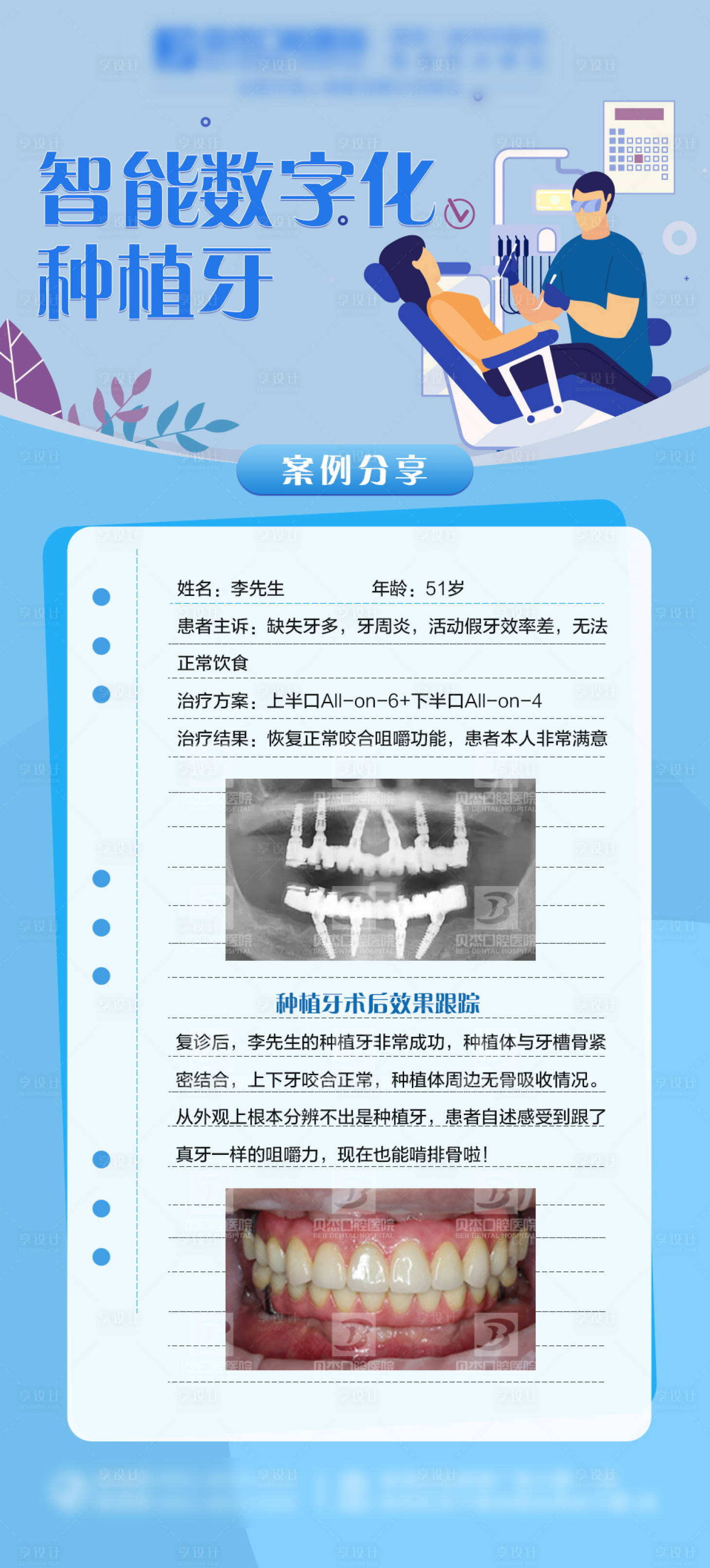源文件下載【享設計】搜索編號：35010010723435902【智能數字化種植牙案例】