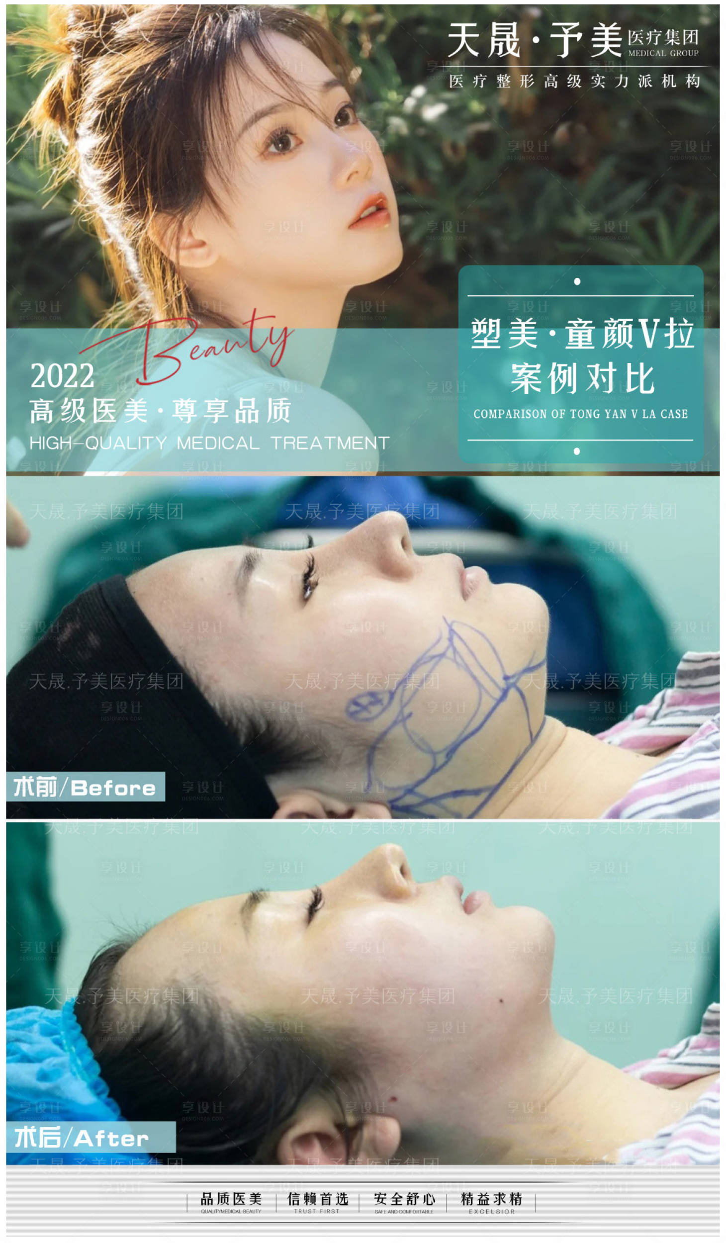 源文件下載【享設計】搜索編號：84300010488942615【醫美案例對比圖】