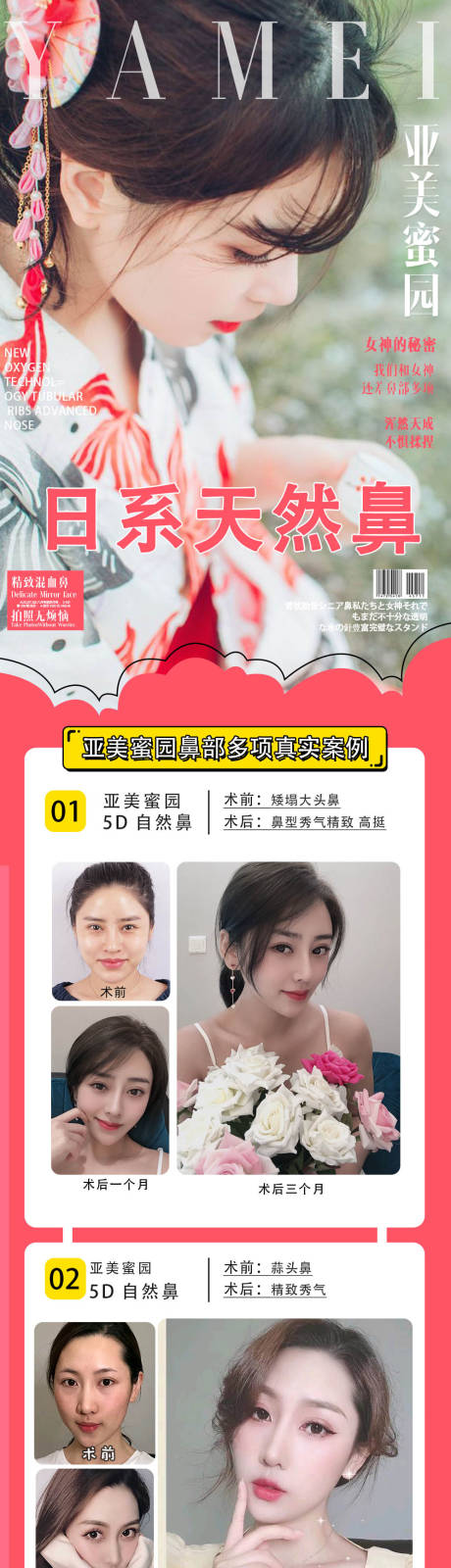 源文件下载【医美鼻详情页】编号：13680010411801966