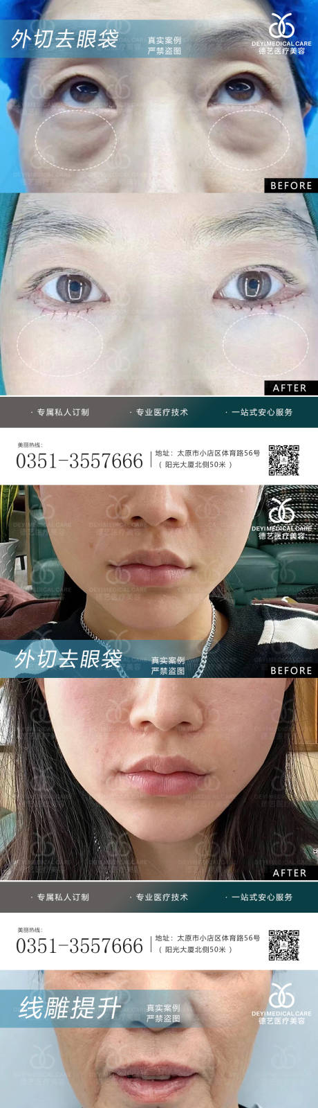源文件下載【享設計】搜索編號：58350010365597267【醫美案例對比圖】