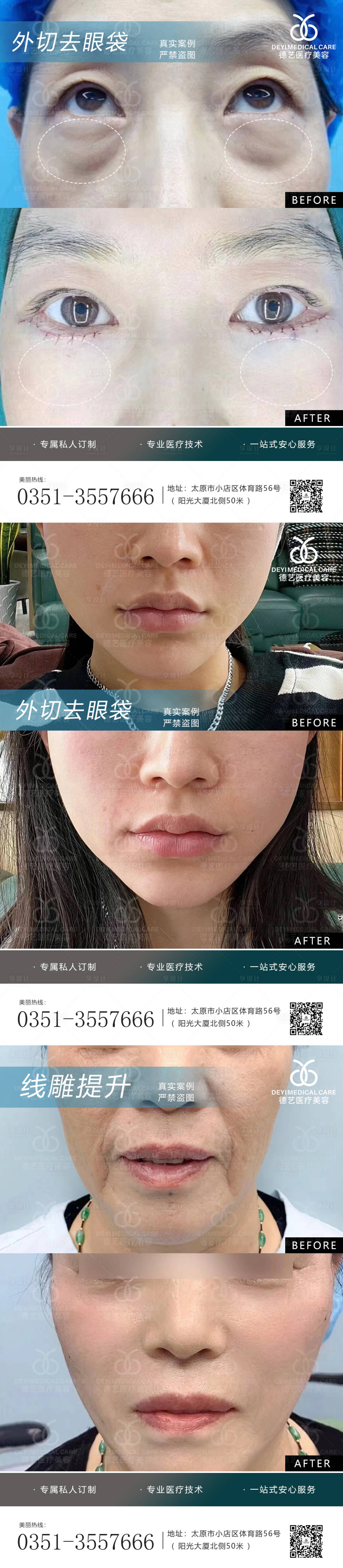 源文件下载【享设计】搜索编号：58350010365597267【医美案例对比图】