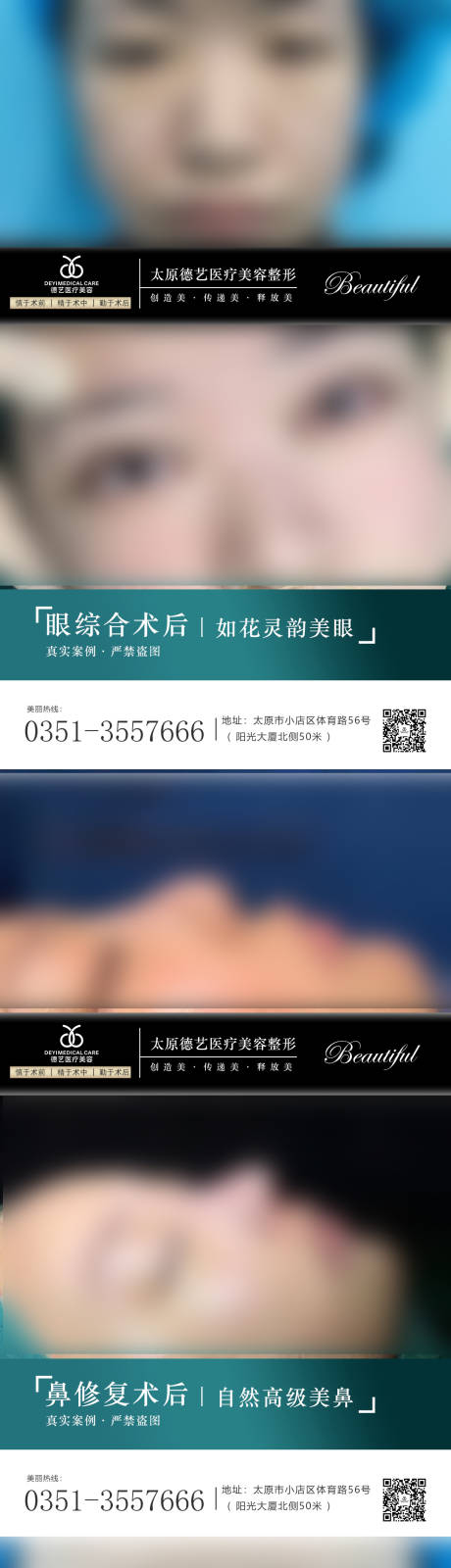 源文件下載【醫(yī)美案例對(duì)比圖海報(bào) 】編號(hào)：85480010525706671
