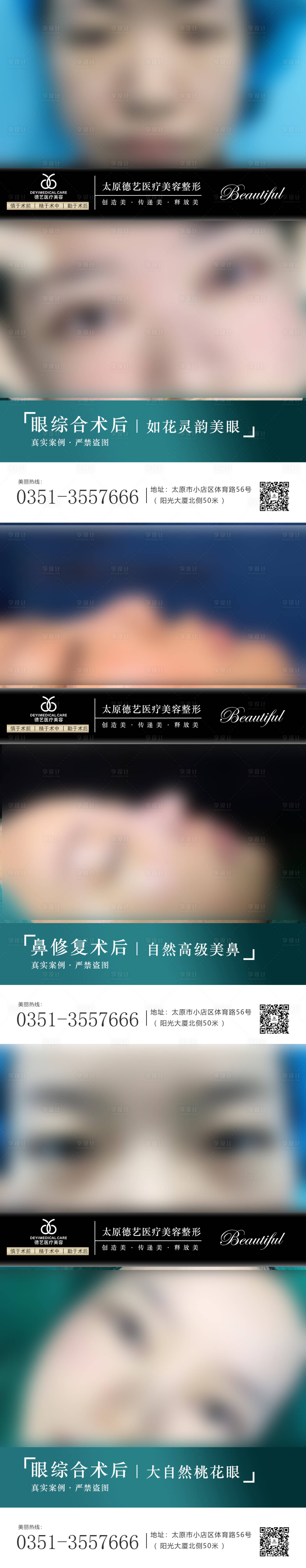 源文件下載【醫美案例對比圖海報 】編號：85480010525706671