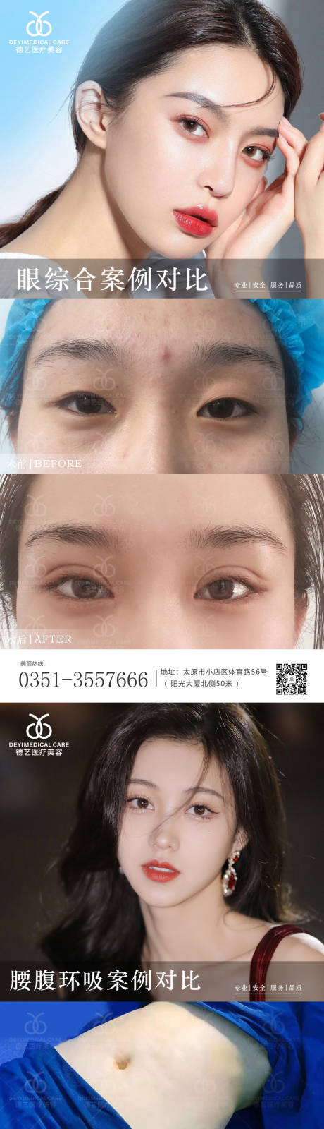 源文件下載【享設計】搜索編號：87790010472017827【醫美案例對比圖海報 】