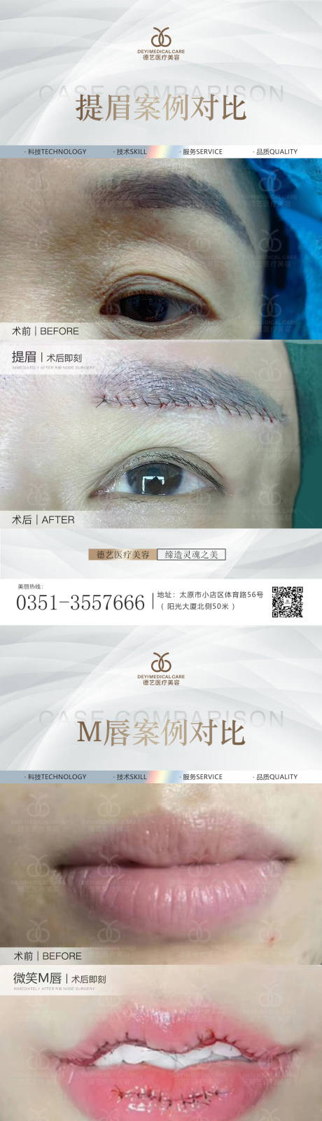源文件下载【医美案例对比图】编号：16860010792515014