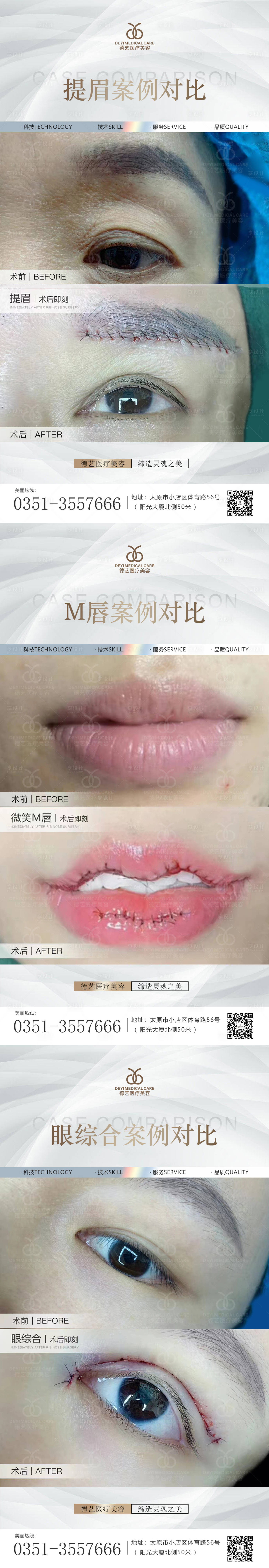 源文件下載【醫美案例對比圖】編號：16860010792515014