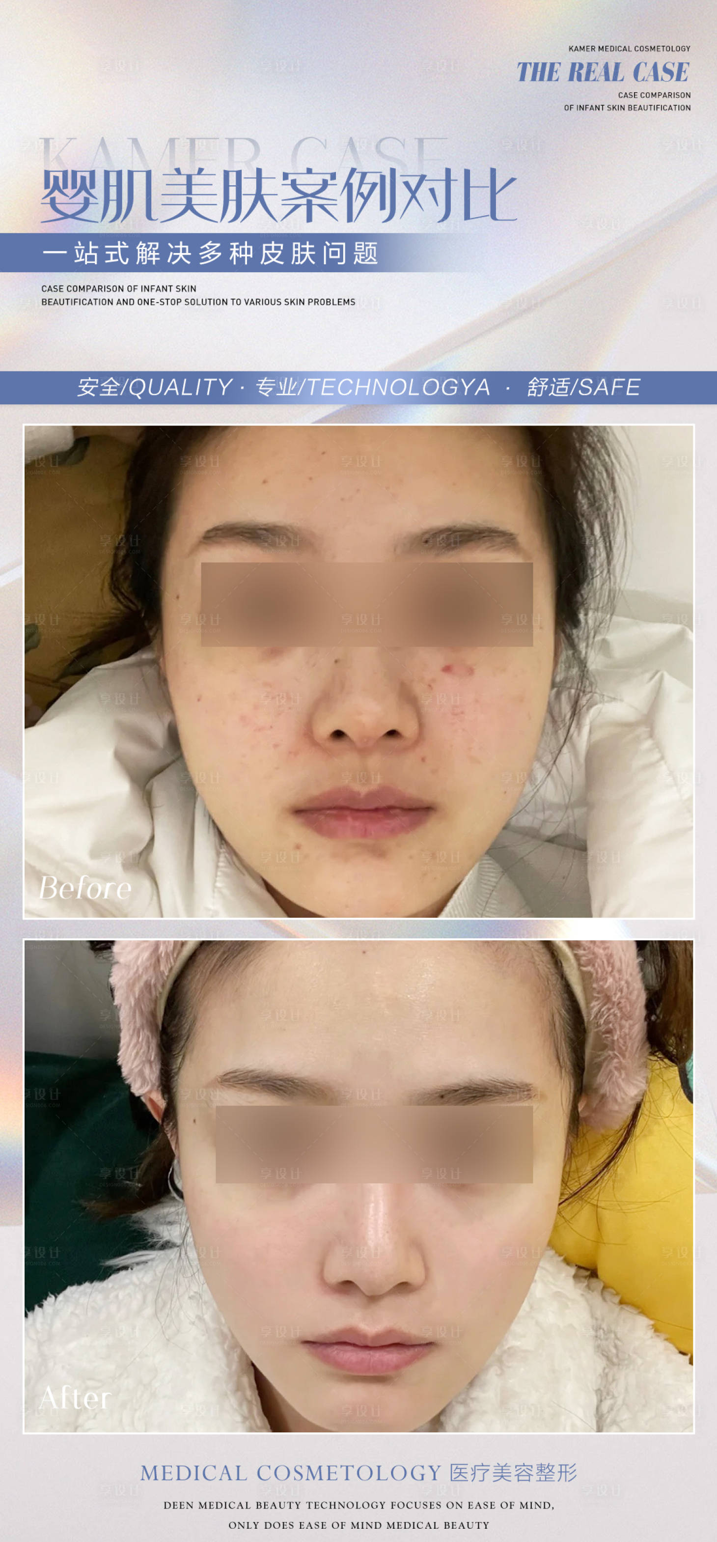 源文件下载【享设计】搜索编号：71270010719787799【美肤案例海报】