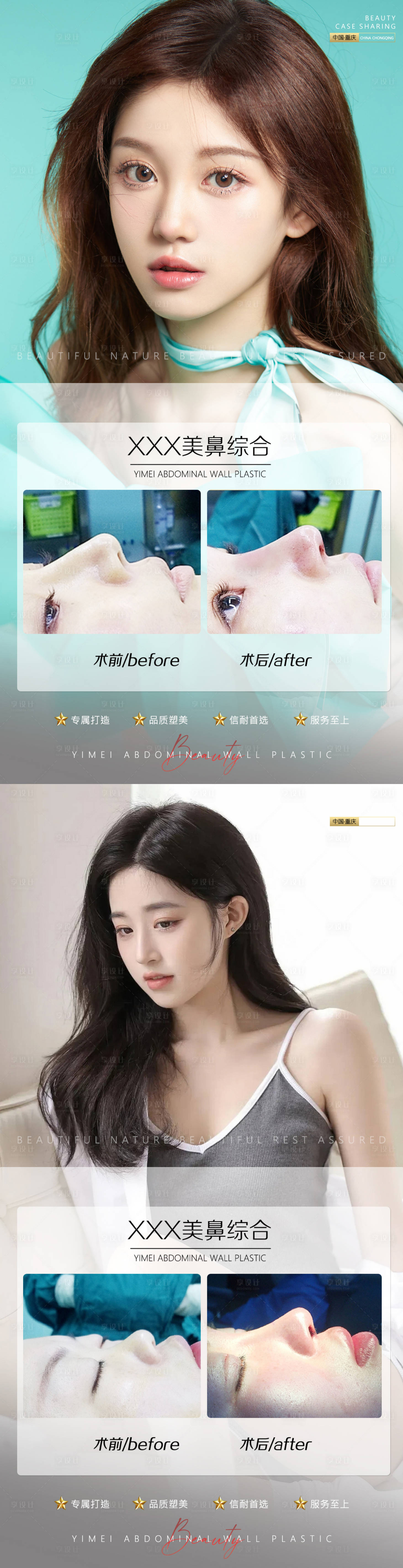 源文件下載【享設計】搜索編號：93640010733516450【醫(yī)美案例鼻子】