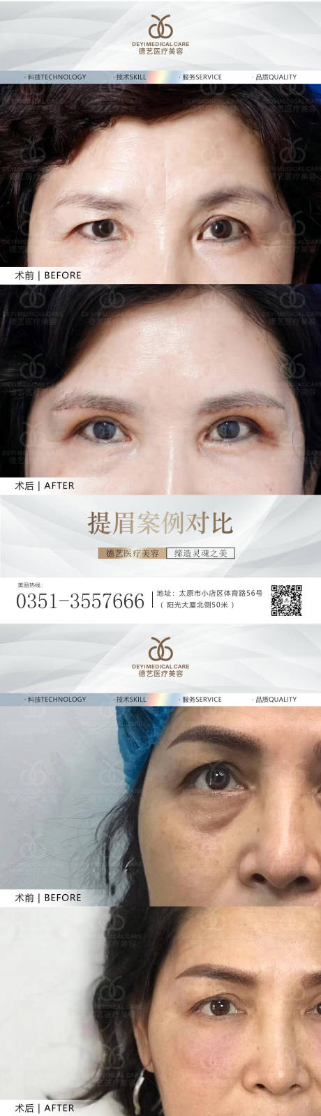 源文件下载【享设计】搜索编号：89380010817749870【医美案例对比图】