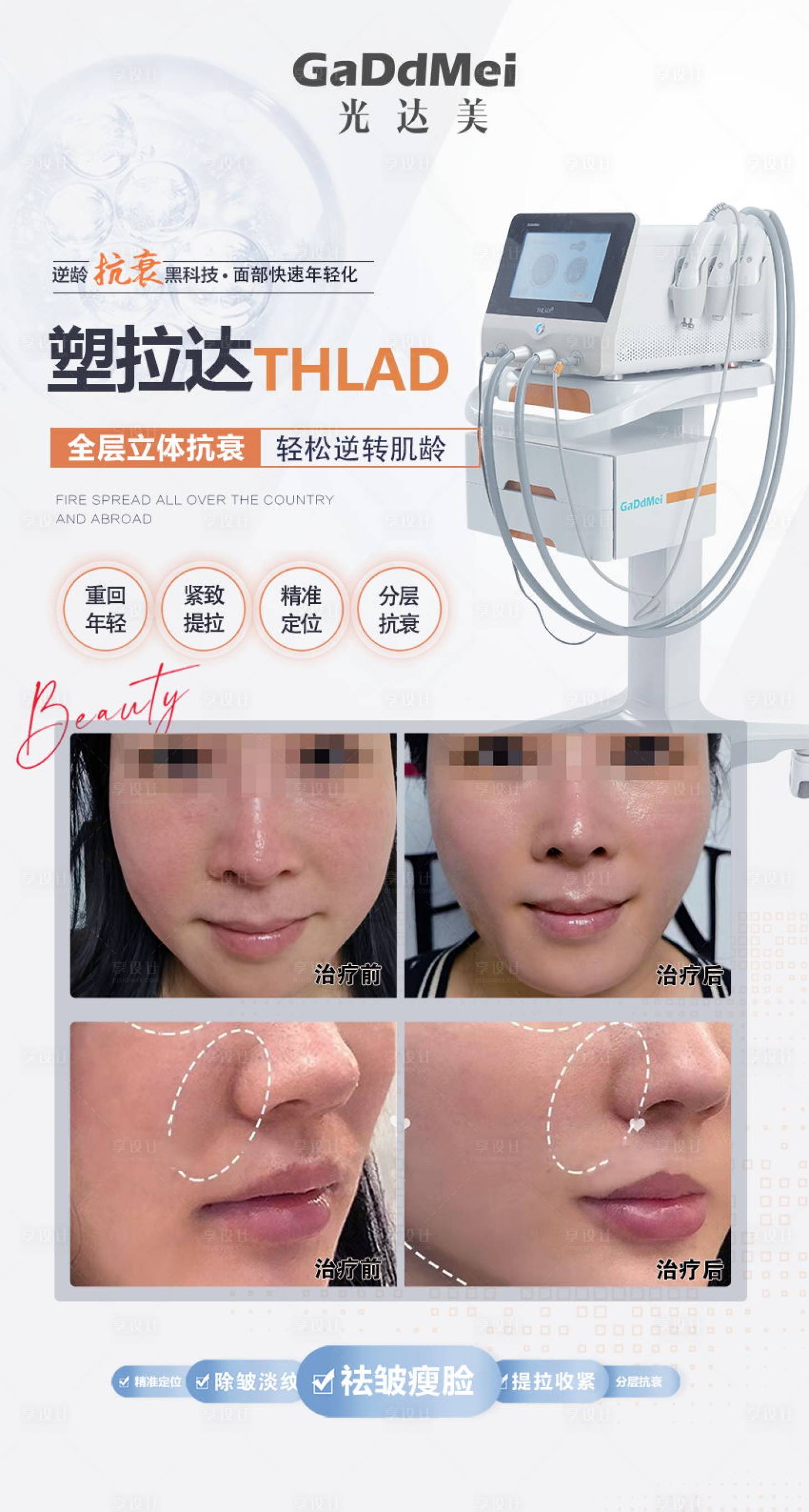 源文件下載【享設計】搜索編號：23270010566267855【醫美整形儀器海報】