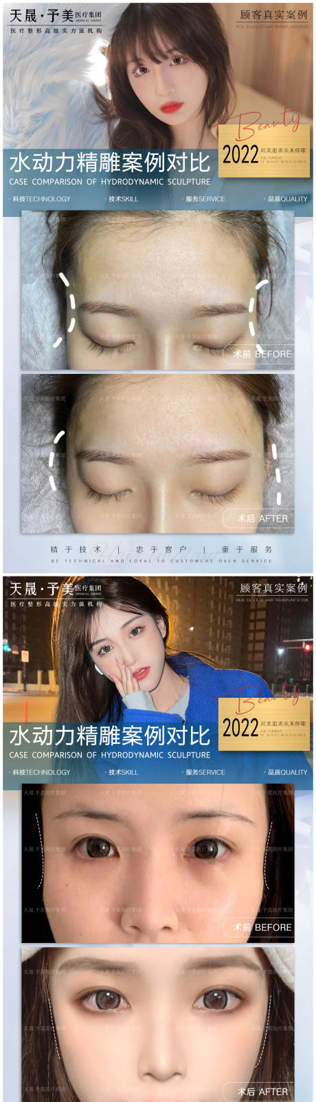 源文件下載【醫美案例對比圖】編號：75240010488886467