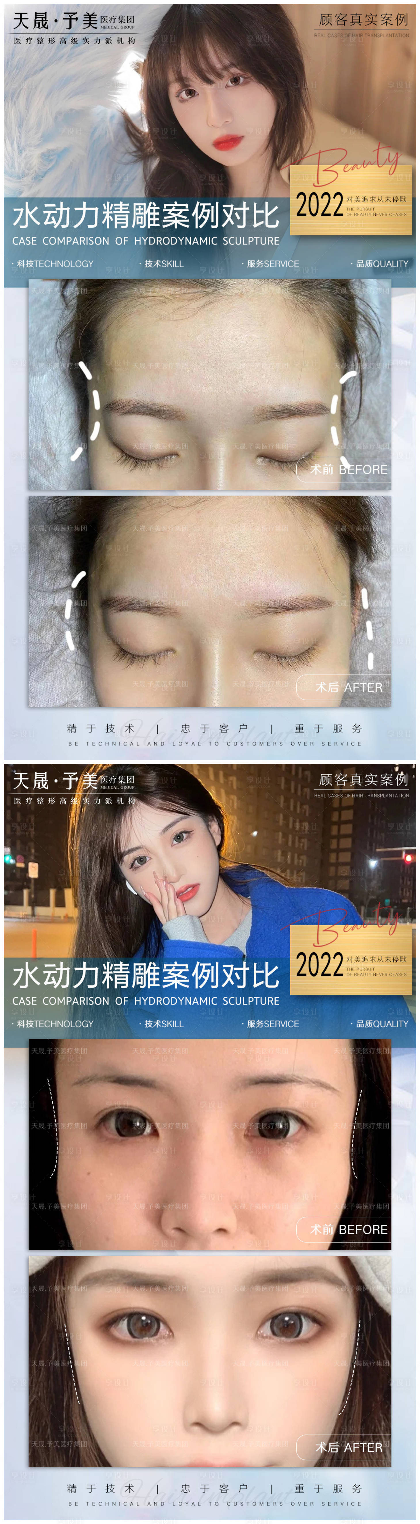 源文件下載【享設計】搜索編號：75240010488886467【醫美案例對比圖】