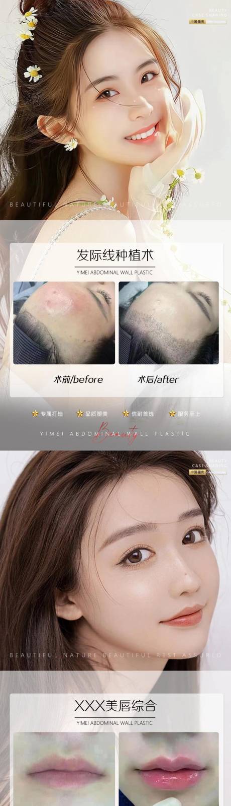 源文件下载【享设计】搜索编号：75970010658446183【医美案例植发唇综合】