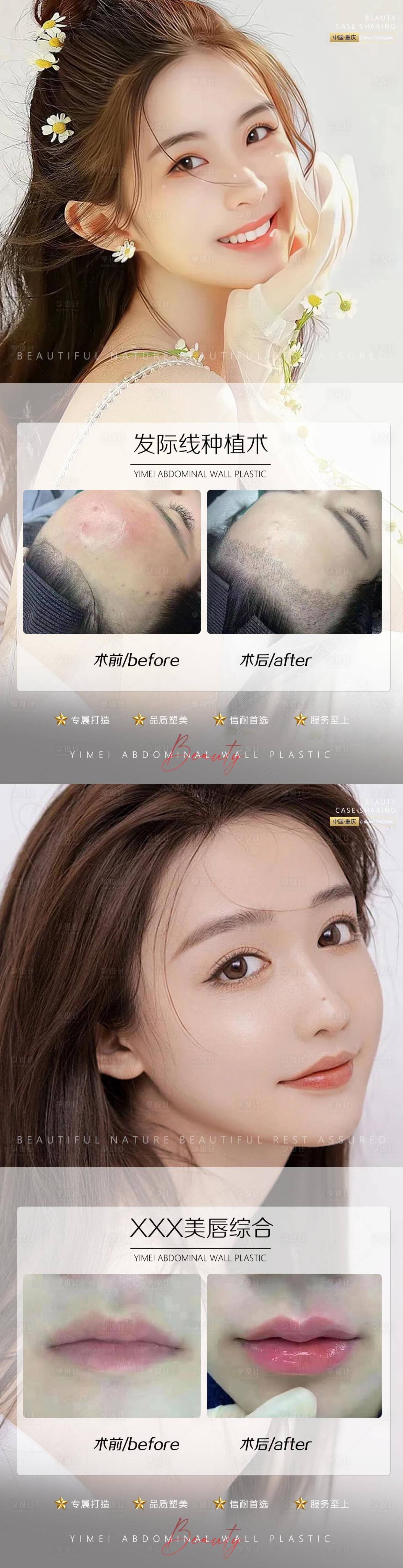源文件下载【享设计】搜索编号：75970010658446183【医美案例植发唇综合】