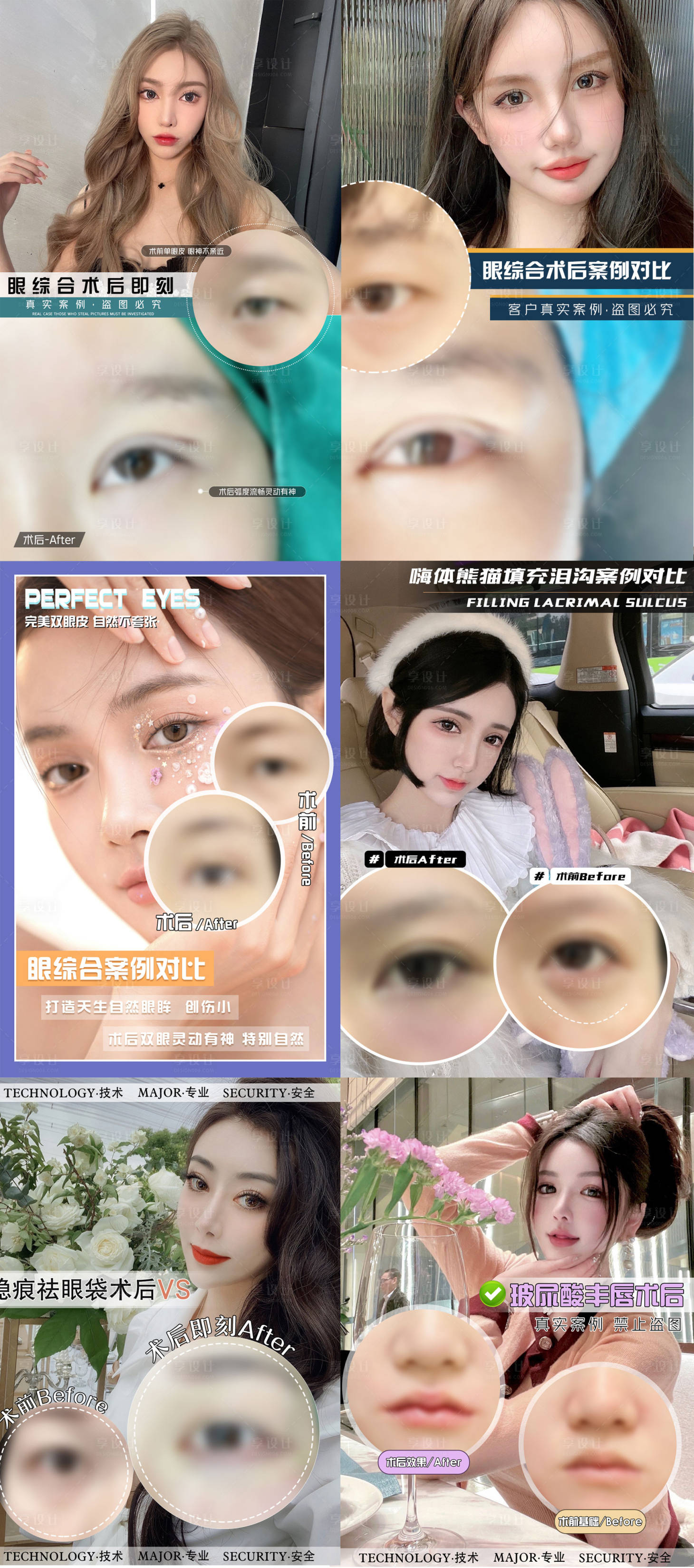 源文件下載【享設計】搜索編號：43240010679177022【醫美整形案例海波】
