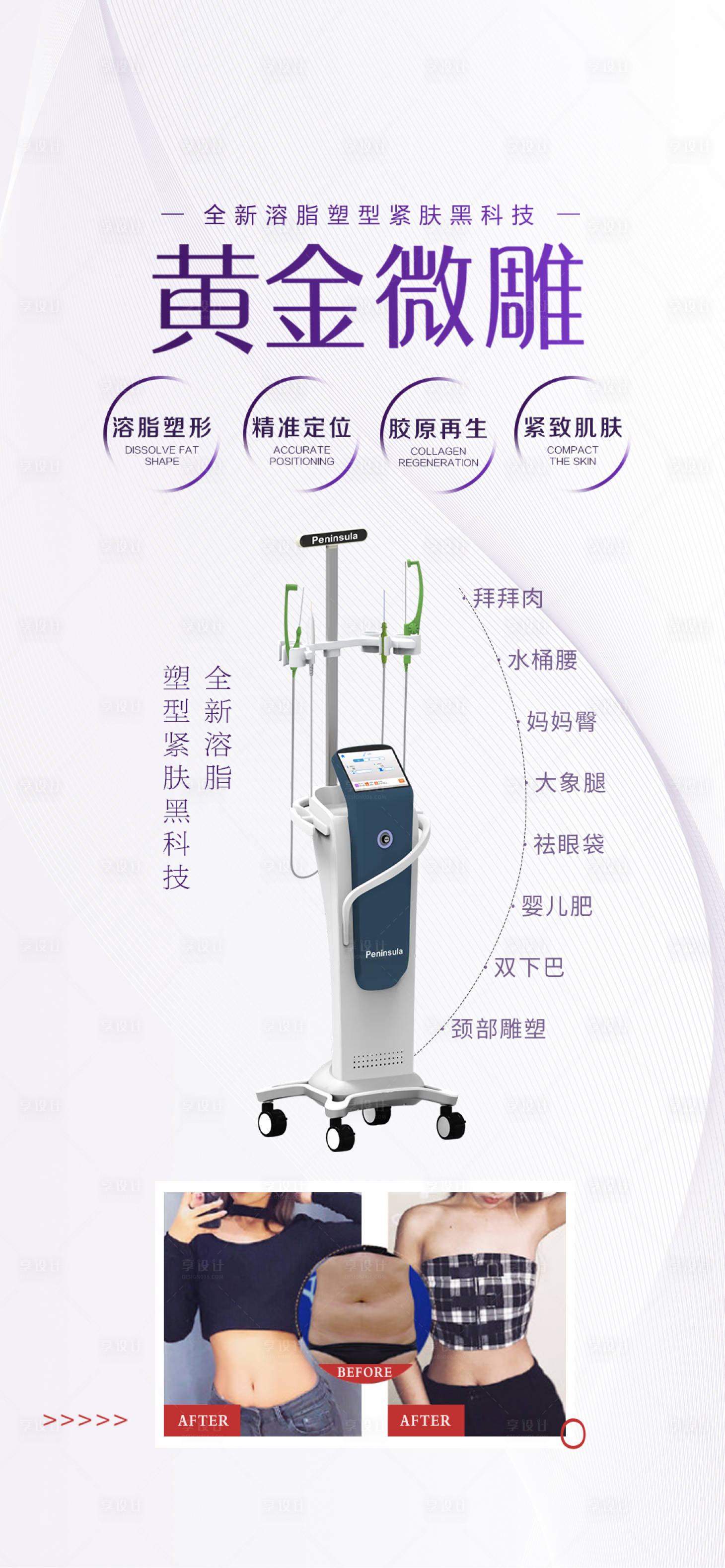 源文件下載【享設(shè)計(jì)】搜索編號(hào)：40270010515149737【醫(yī)美黃金微針海報(bào)】