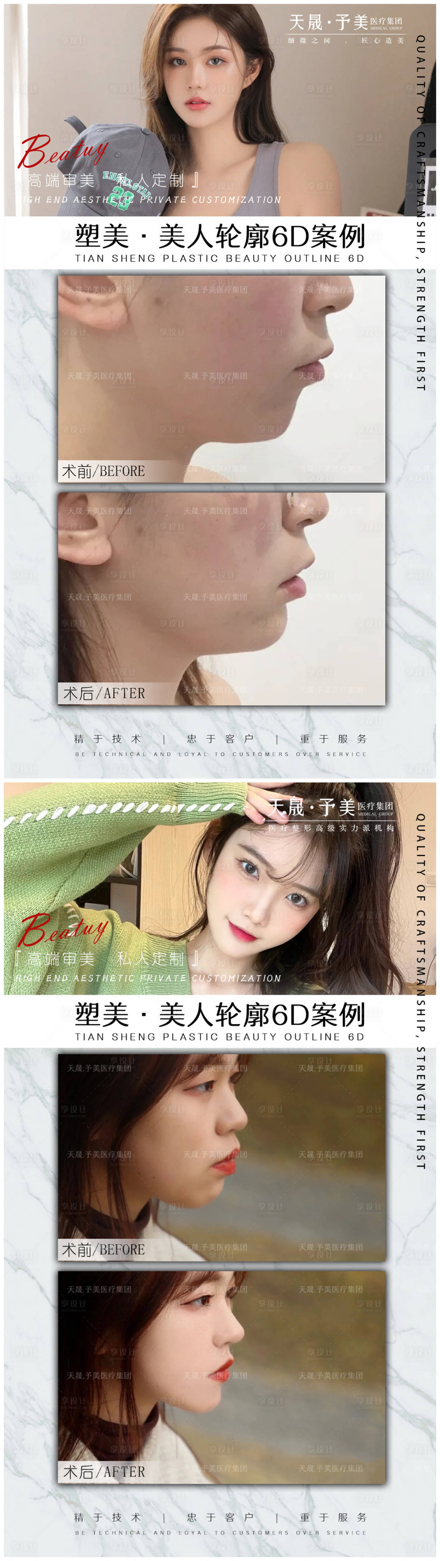 源文件下載【享設計】搜索編號：37560010488719819【醫美整形案例】