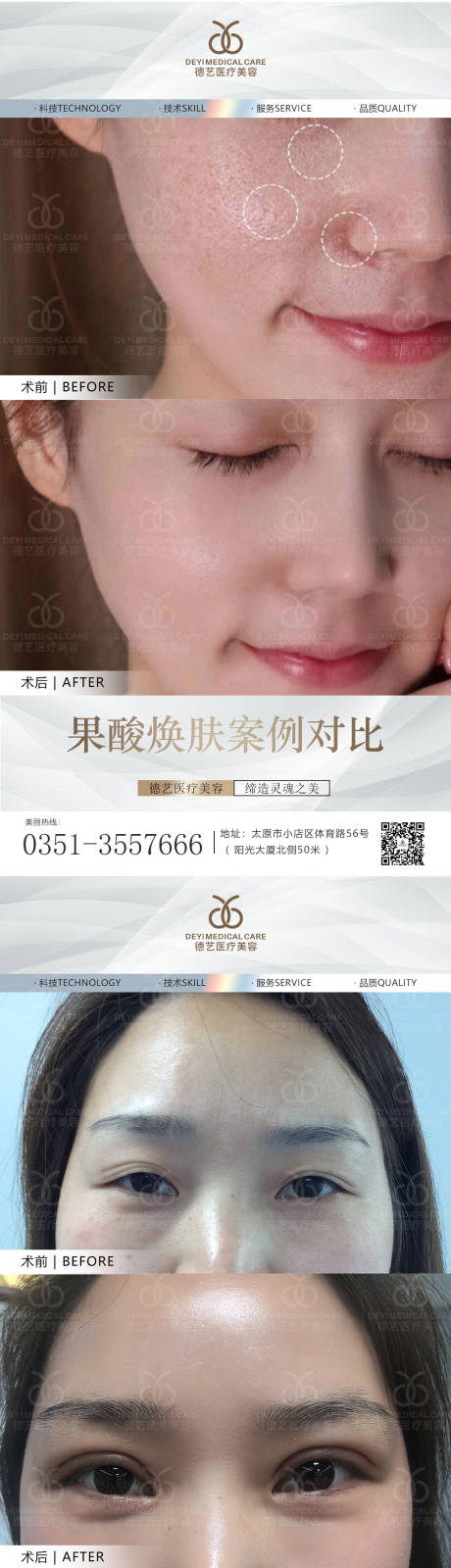 源文件下载【医美案例对比图】编号：96610010823232043