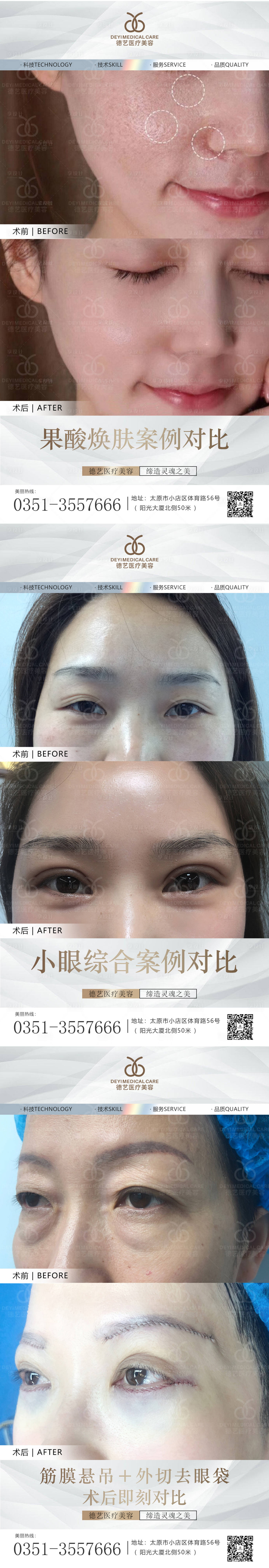 源文件下載【享設(shè)計(jì)】搜索編號(hào)：96610010823232043【醫(yī)美案例對(duì)比圖】