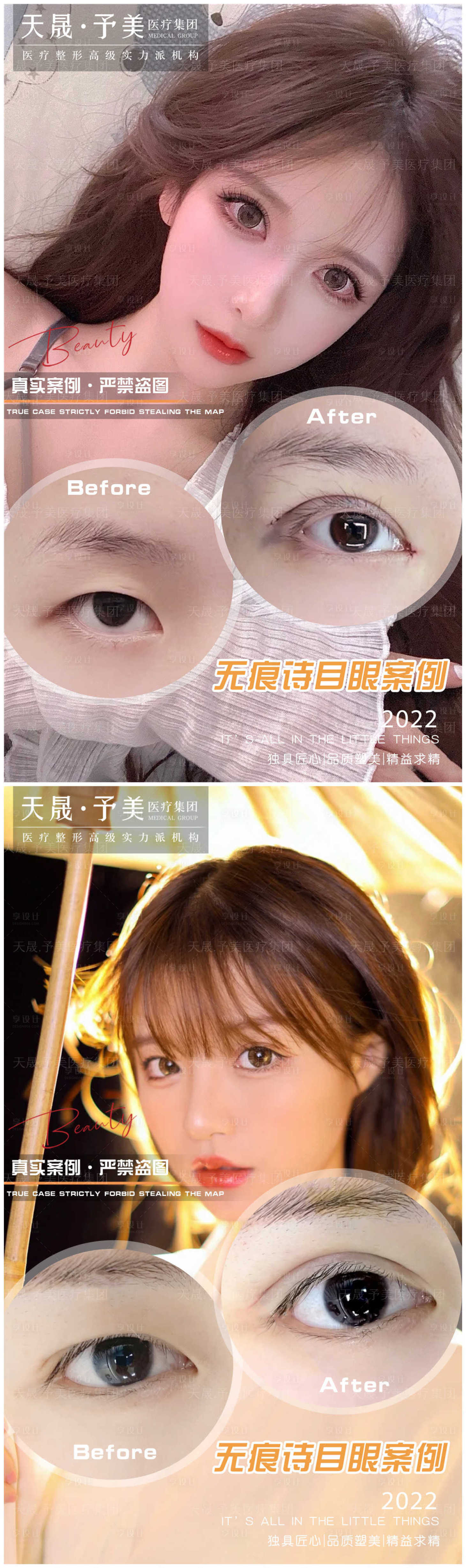 源文件下载【享设计】搜索编号：66000010488967870【医美案例对比图】