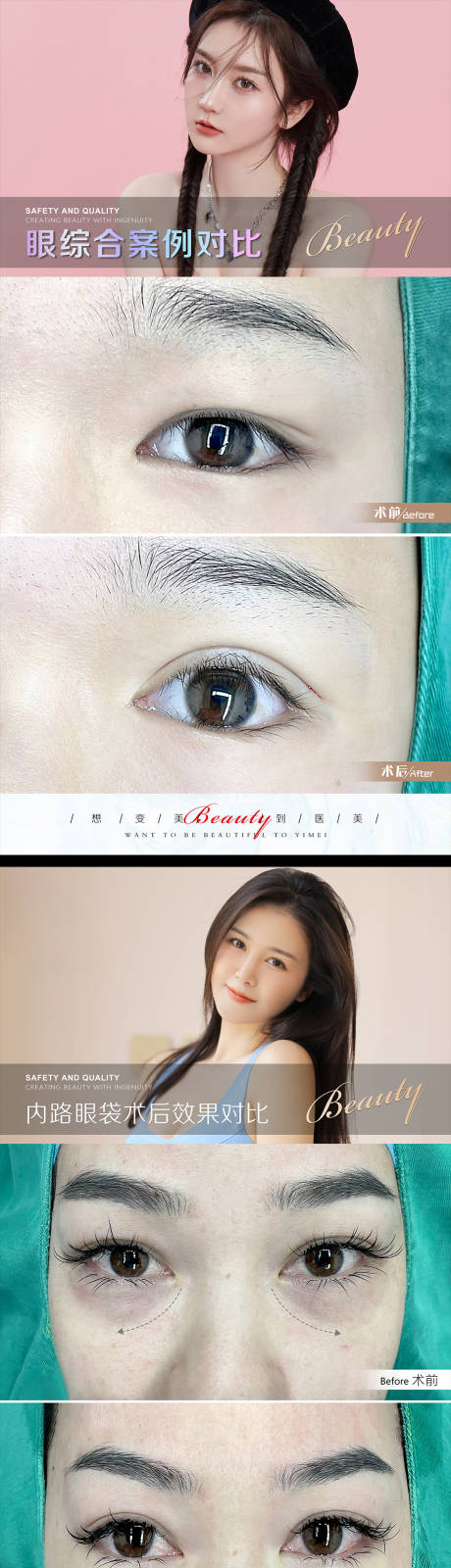 源文件下载【享设计】搜索编号：94450010735823248【医美案例模板】