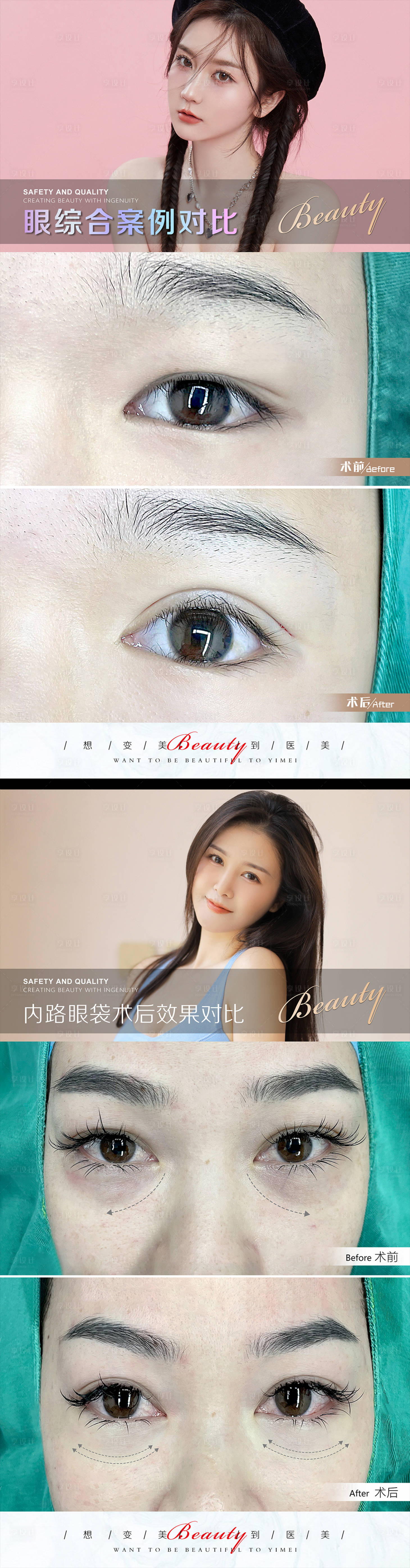 源文件下载【享设计】搜索编号：94450010735823248【医美案例模板】